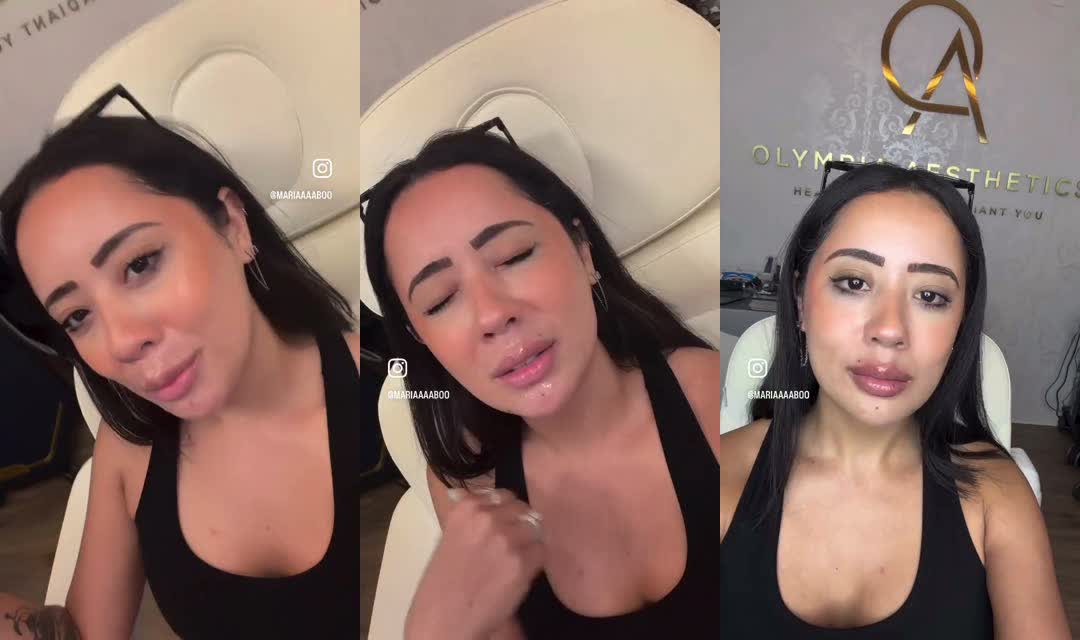 Olympia Aesthetics lip filler patient sharing her results in Palm Harbor
