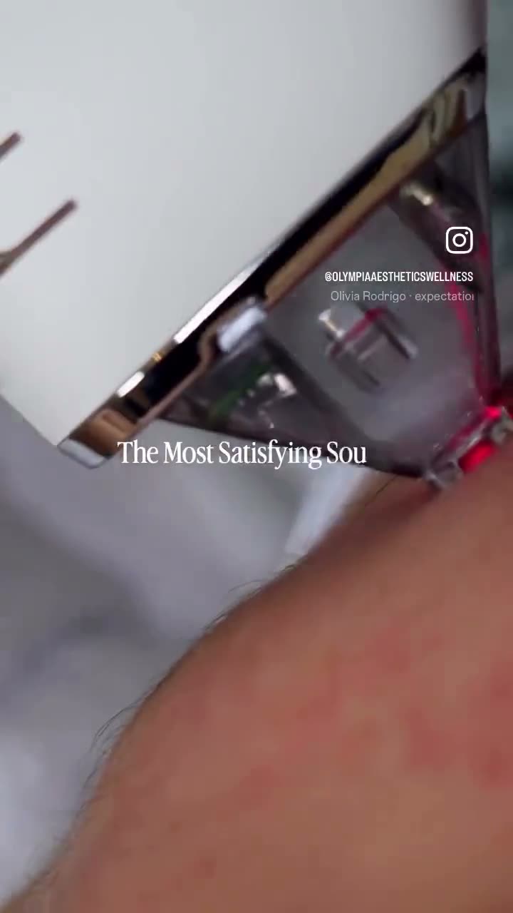 Sciton MOXI laser passing over a patient's skin with the sound of the device at Olympia Aesthetics