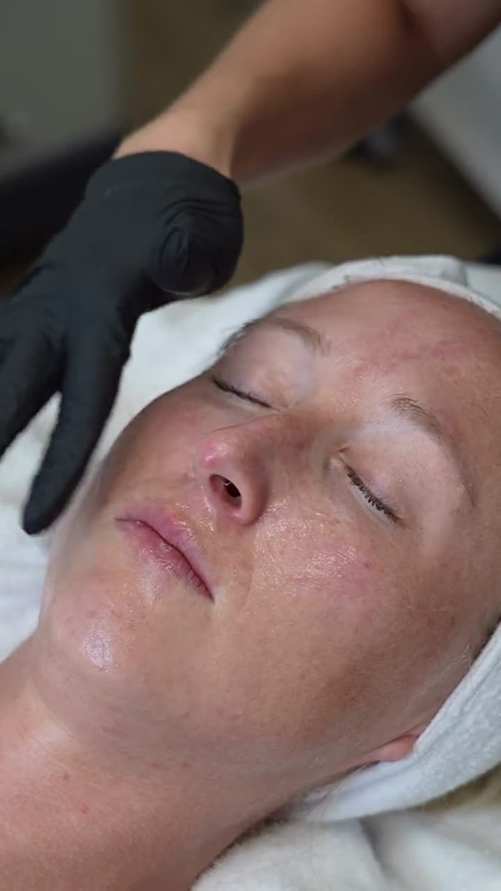 Olympia Morris, PA-C performing and explaining a SkinPen microneedling treatment at Olympia Aesthetics in Palm Harbor
