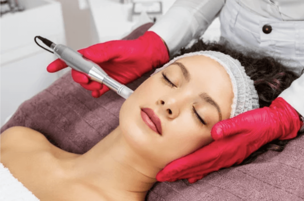 microneedling near me