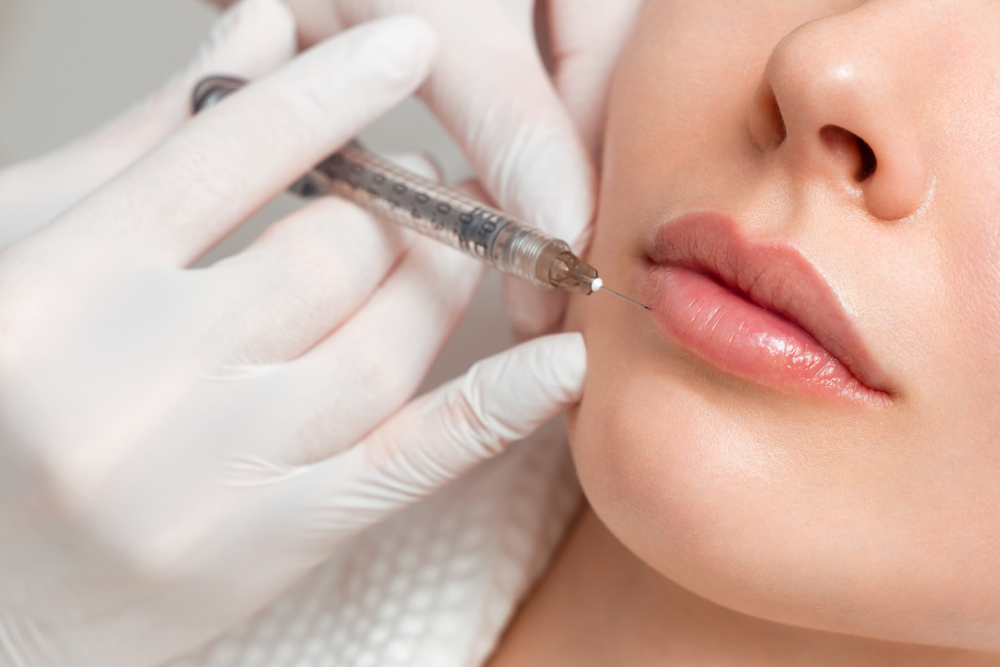 Professional lip filler injection treatment in Palm Harbor.