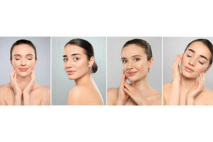 olympia aesthetics in palm harbor fl Collage of women showing smooth skin results from Sciton ProFractional