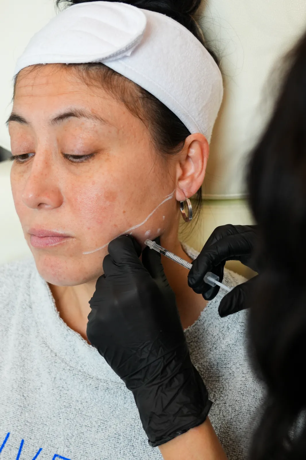 Olympia Morris, PA-C placing jawline and neck filler with anatomical markings at Olympia Aesthetics in Palm Harbor