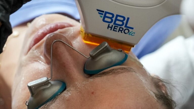 How to Treat Facial Redness, From Flushing to Persistent Redness
