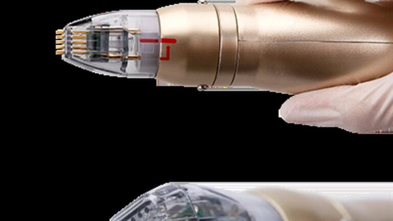 RF Microneedling: Morpheus8 vs Sylfirm X, and What We Use